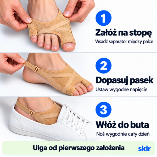 HaluStoper – korektor haluksów do noszenia w bucie