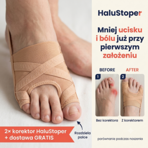HaluStoper - Korektor Haluksów łagodzący ból i zapobiegający otarciom